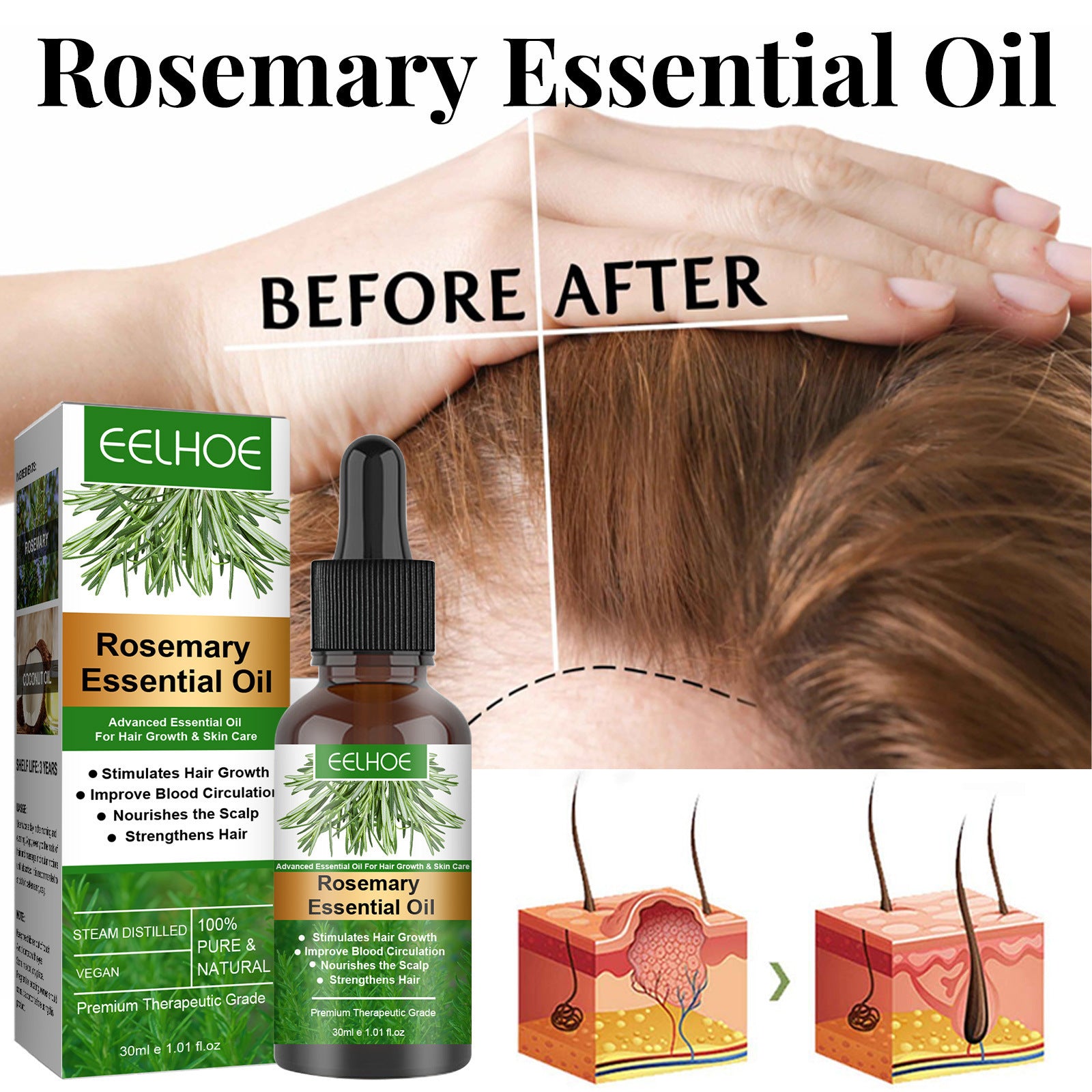 Rosemary essential oil product with 'before' and 'after' hair growth illustration, EELHOE brand visible.