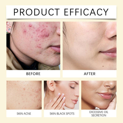 AureliaBright™ Turmeric + Kojic Acid Radiance Cleansing Pads