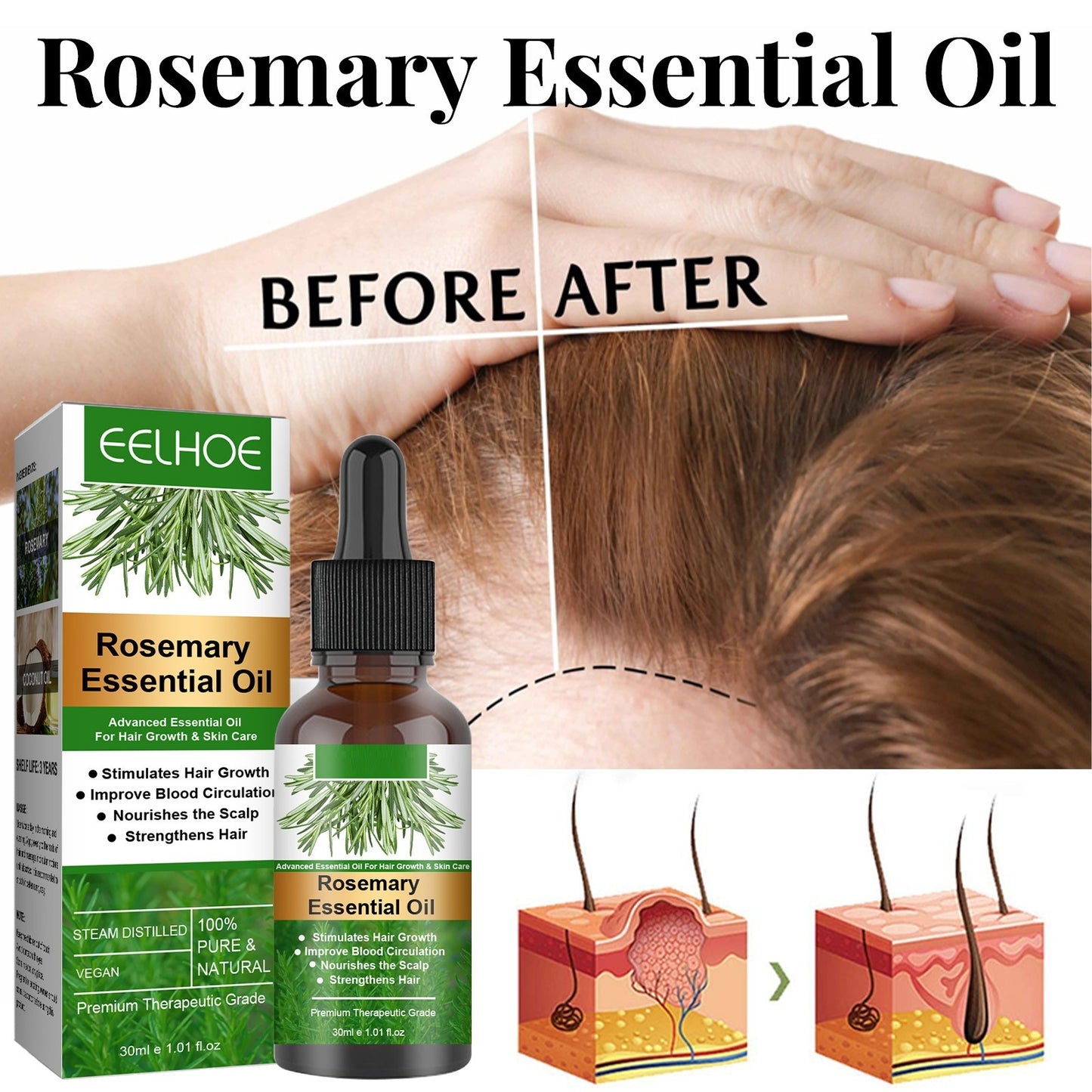 Rosemary essential oil bottle and packaging with 'before' and 'after' hair growth illustration.