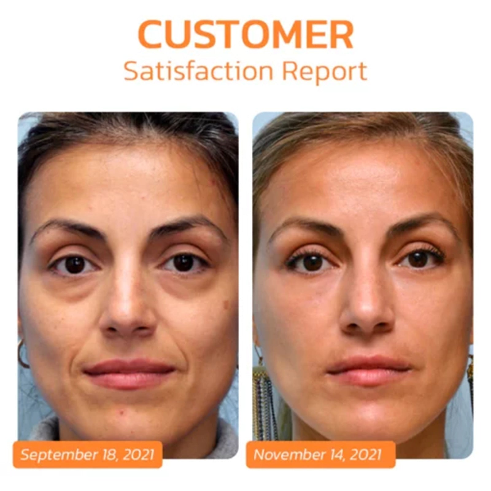 Before and after comparison of a woman's face with text indicating a customer satisfaction report.