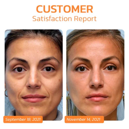 Before and after comparison of a woman's face with text indicating a customer satisfaction report.