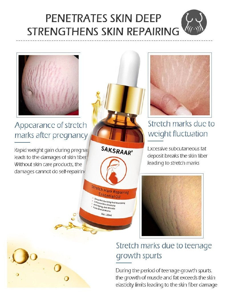 Stretch Marks Removal Essential Oil – Tea Tree Infused Body Care