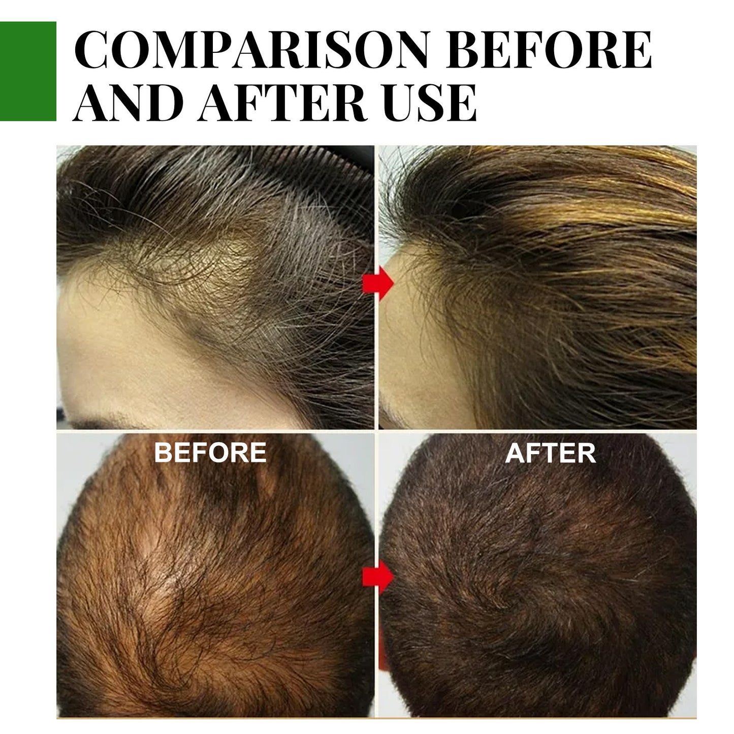 Rosélienne™ Rosemary Fortifying Hair Elixir