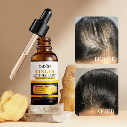 Sadoer Ginger Anti-Hair Loss Treatment Essence bottle with dropper, ginger root, and before-and-after hair comparison on a beige background.