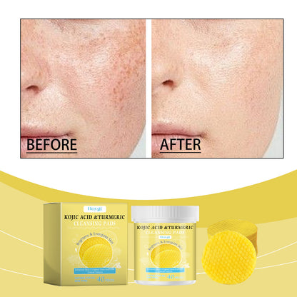 AureliaBright™ Turmeric + Kojic Acid Radiance Cleansing Pads