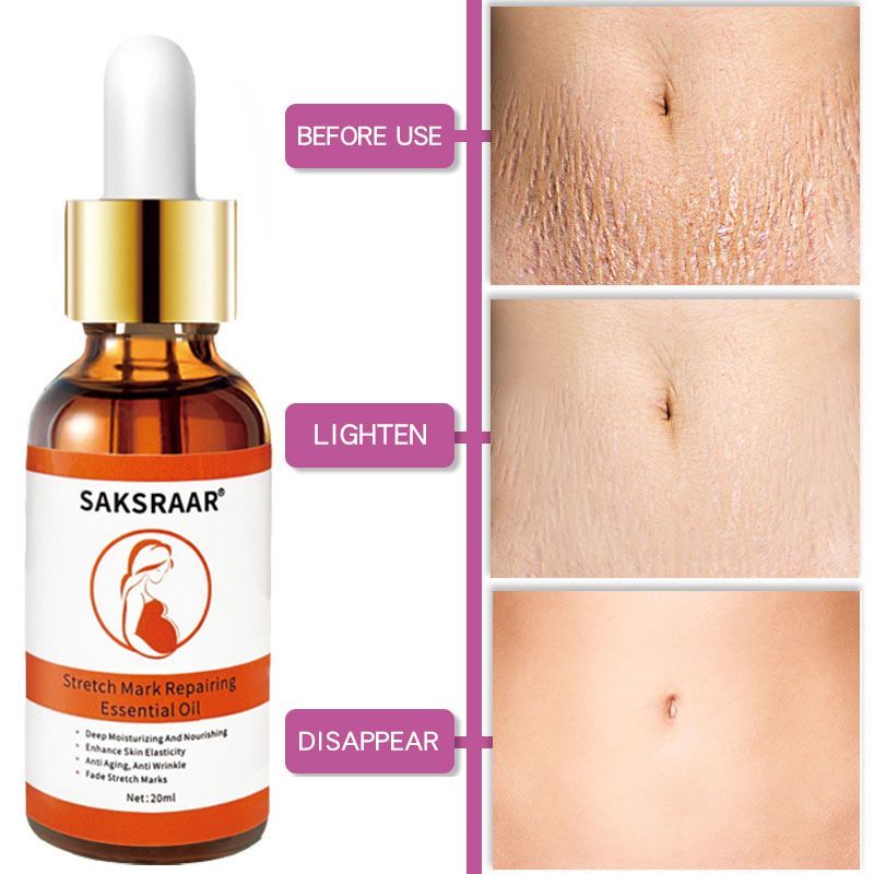 Stretch Marks Removal Essential Oil – Tea Tree Infused Body Care